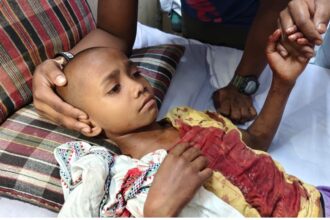 Kanker Leopard Attack