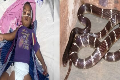 Snake Bite Survival