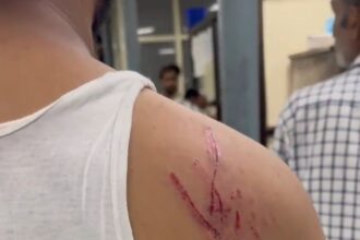 Dog Attack Case
