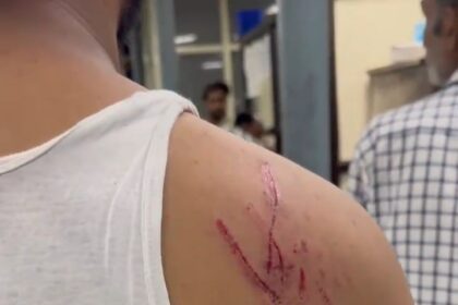 Dog Attack Case