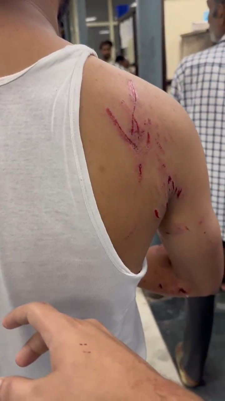 Dog Attack Case