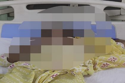 Nurse Acid Attacked