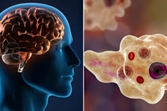 Brain Eating Amoeba Kerala