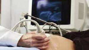 Free Ultrasound Pregnancy