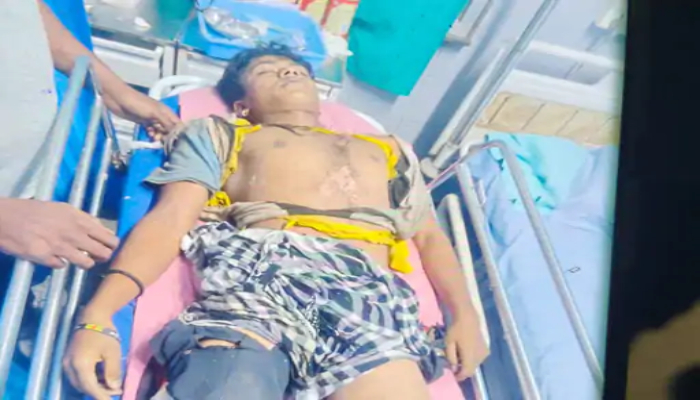 Student struck by lightning