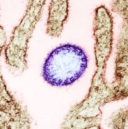 Kerala Nipah Virus