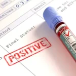 Injection Drug Abuse