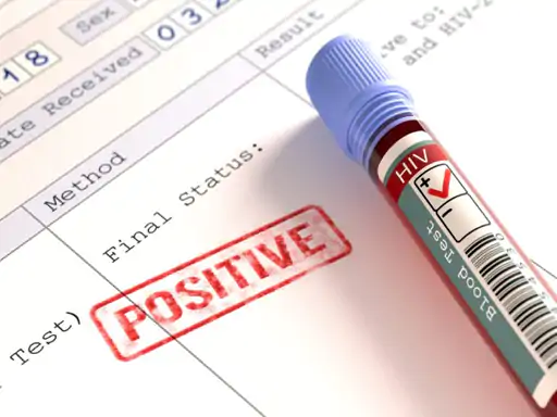 Injection Drug Abuse