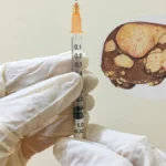 Liver Health