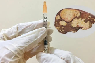 Liver Health