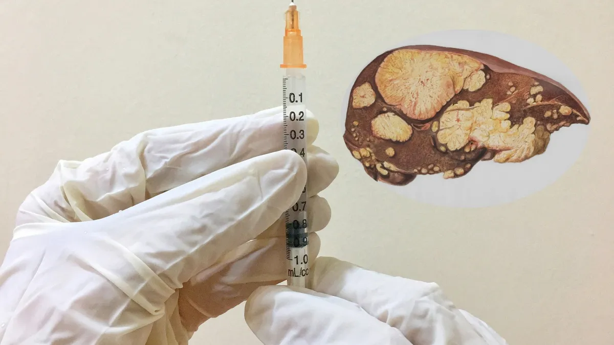 Liver Health