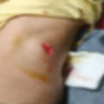 Raipur Stabbing Incident