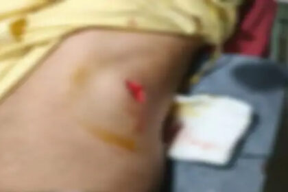 Raipur Stabbing Incident