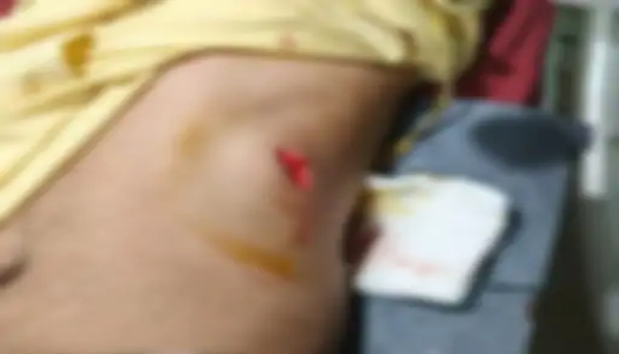 Raipur Stabbing Incident