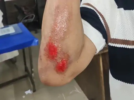Raipur stabbing incidents