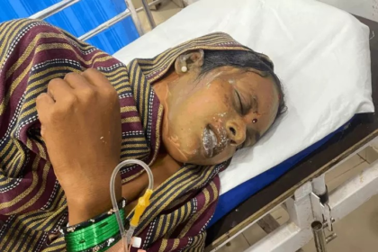 Durg Acid Attack