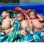 Triple Baby Birth Balrampur : पहाड़ी कोरवा महिला की हाई रिस्क डिलीवरी, एक साथ जन्मे तीन बच्चे