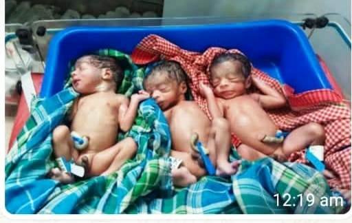 Triple Baby Birth Balrampur : पहाड़ी कोरवा महिला की हाई रिस्क डिलीवरी, एक साथ जन्मे तीन बच्चे
