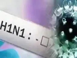 Swine Flu Durg : दुर्ग में 5 नए मरीज मिले, संक्रमितों की संख्या 22 पहुंची; 158 बेड रिजर्व