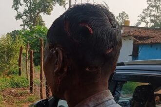 Bear Attack Chhattisgarh