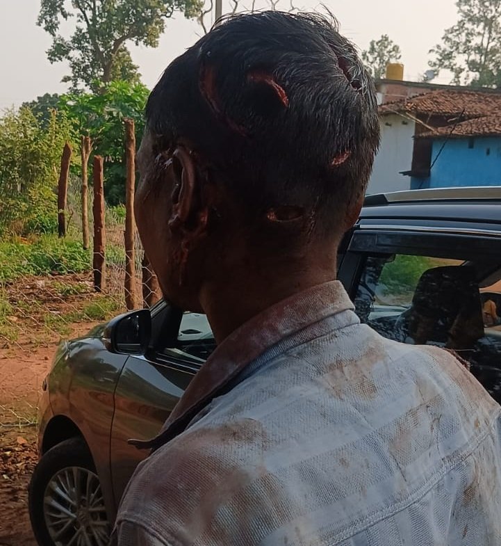 Bear Attack Chhattisgarh