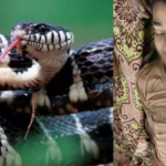 Common Krait Snake Bite