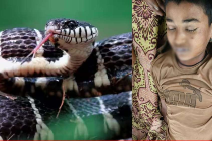 Common Krait Snake Bite