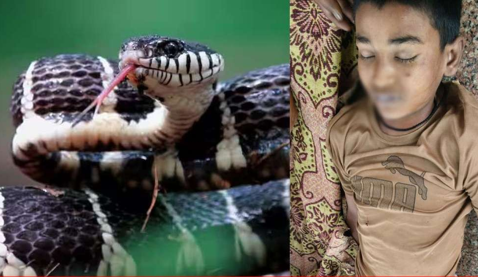 Common Krait Snake Bite