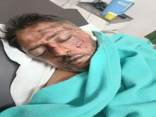 Bilaspur Youth Attack Case