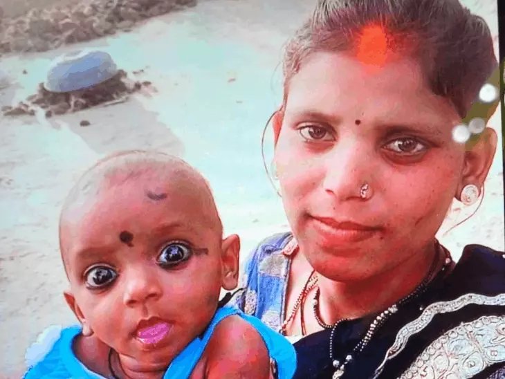 Child Burning Death Case