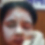 Balod Student Acid Attack