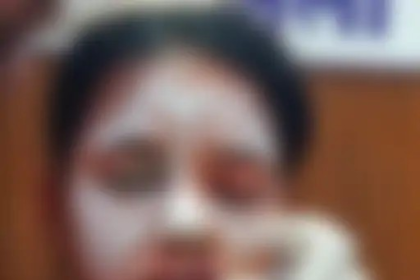 Balod Student Acid Attack