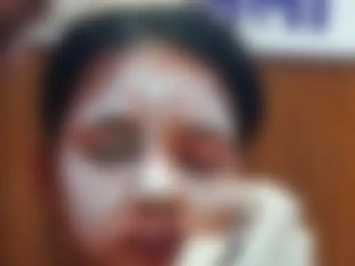 Balod Student Acid Attack
