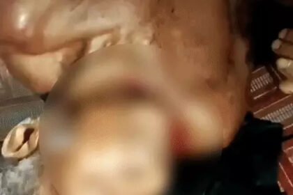Minor Assault Death Case